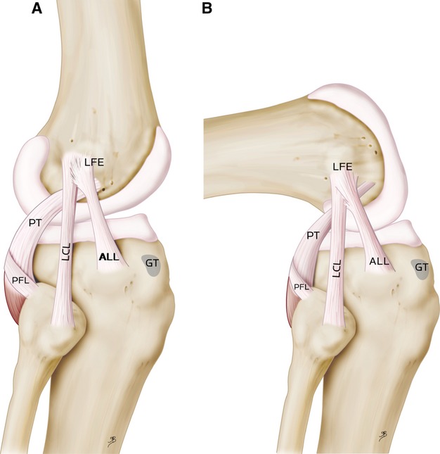 O Rec M Descoberto Ligamento Anterolateral Da Articula O Do Joelho