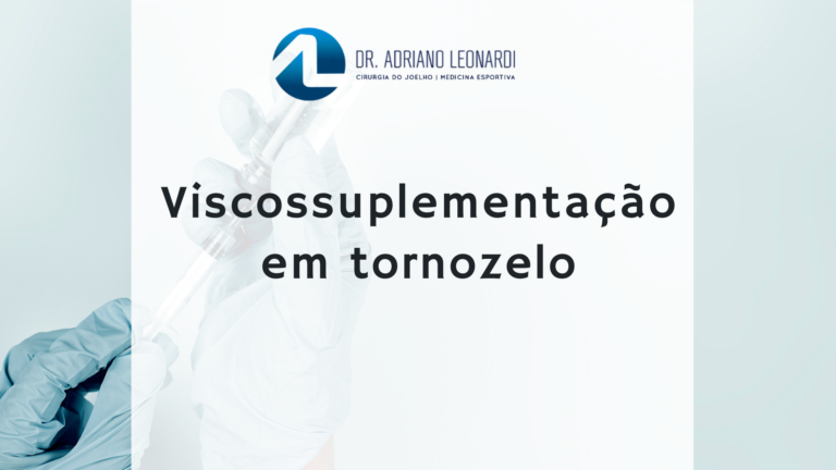 Artrose Em Jovens Osteotomia Valgizante Da T Bia Especialista Do