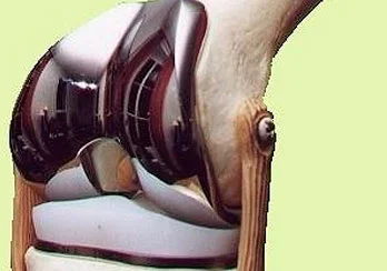 protese total do joelho