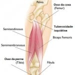 lesão muscular posterior da coxa