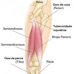 Isquiotibiais: como evitar e tratar lesões no posterior da coxa