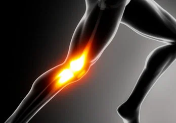 artrose do joelho esporte