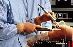 Cirurgia de Rotura do Menisco Cirurgia de Rotura do Menisco