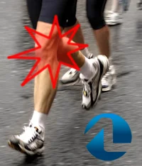 Causas da tendinite do corredor.