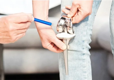 As 10 principais dúvidas sobre a Prótese de Joelho miniatura