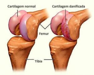 terapia regenerativa para reconstrução de cartilagem