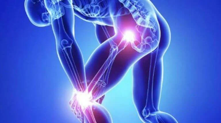 diferenca artrite artrose miniatura