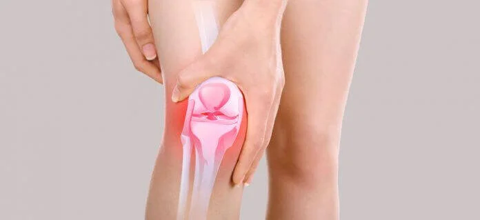 valgo dinamico genese condromalacia 5