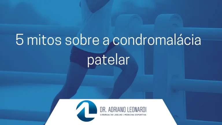 5 mitos sobre a condromalácia patelar