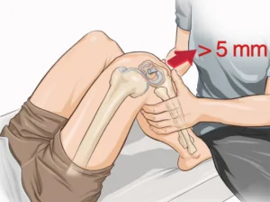 Teste de gaveta anterior