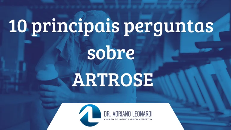 10 principais perguntas sobre artrose