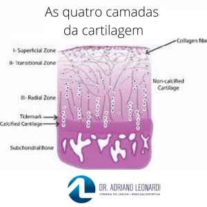 COLÁGENO TIPO 2 para ARTROSE: Funciona? 