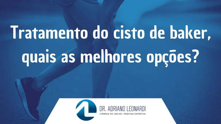 Tratamento do cisto de Baker, quais as melhores opções?