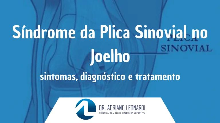 Síndrome da Plica Sinovial no Joelho: sintomas, diagnóstico e tratamento