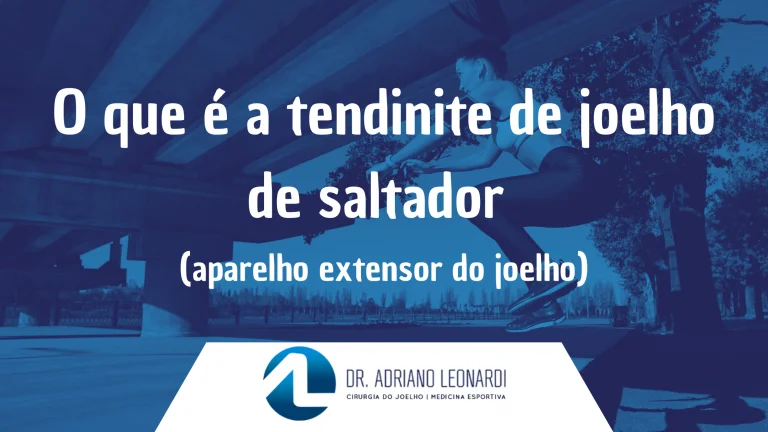 O que é a tendinite de joelho de saltador (aparelho extensor do joelho)?