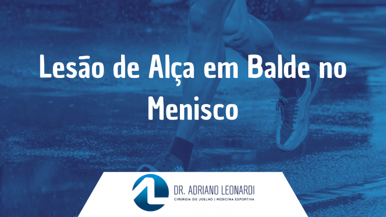 Lesão de Alça em Balde no Menisco