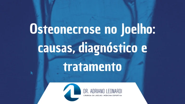 Osteonecrose no joelho