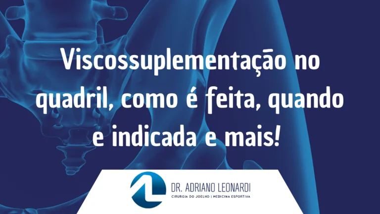Viscossuplementação no quadril 1