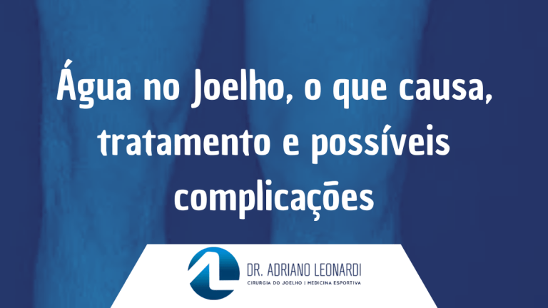 Água no Joelho, o que causa, tratamento e possíveis complicações