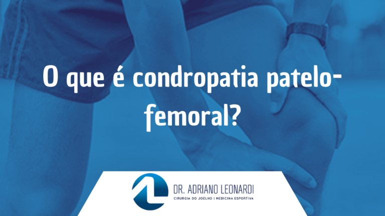 O que é condropatia patelo-femoral?