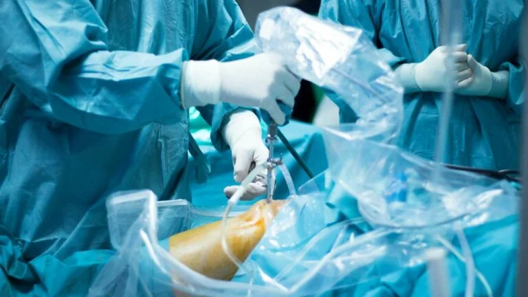 Artroscopia do joelho.