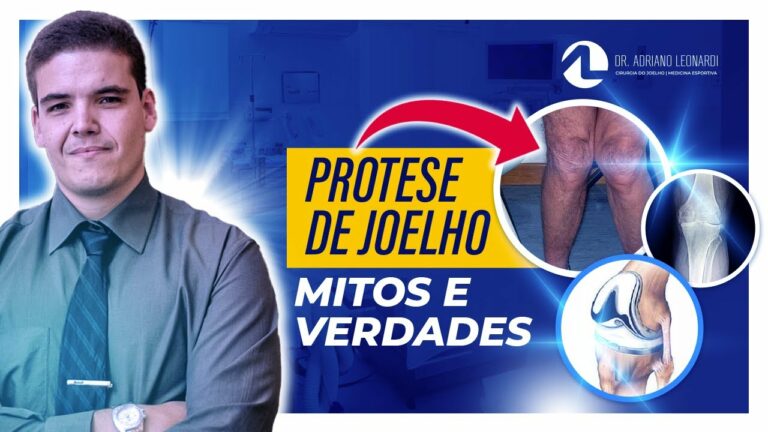 Prótese de joelho e os principais mitos e verdades.