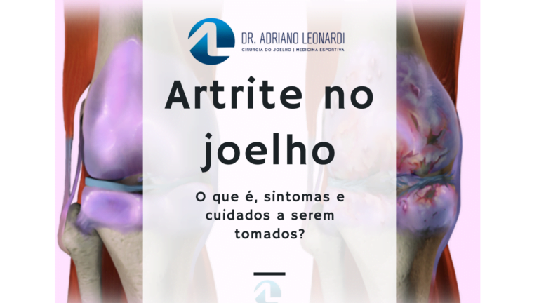 artrite no joelho