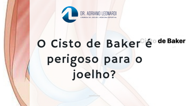 cisto de baker é perigoso
