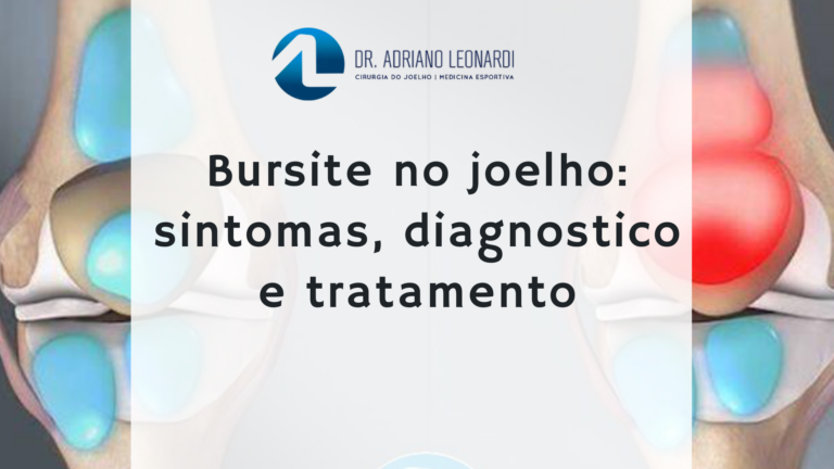 bursite no joelho