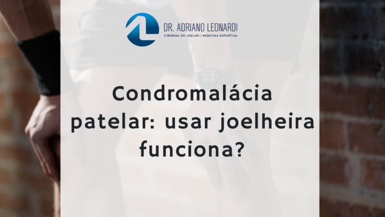 Condromalácia patelar: usar joelheira funciona?