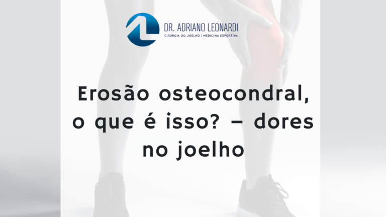 EROSÃO OSTEOCONDRAL