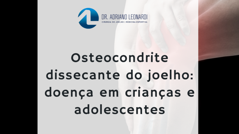 OSTEOCONDRITE DISSECANTE DO JOELHO