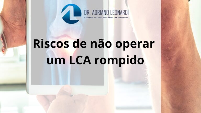 Riscos de não operar um LCA rompido: impactos profundos na saúde do joelho