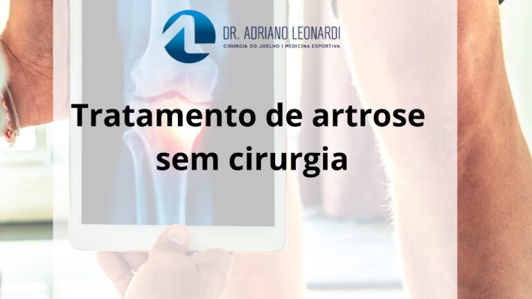Tratamento de artrose sem cirurgia abordagens conservadoras para alívio dos sintomas