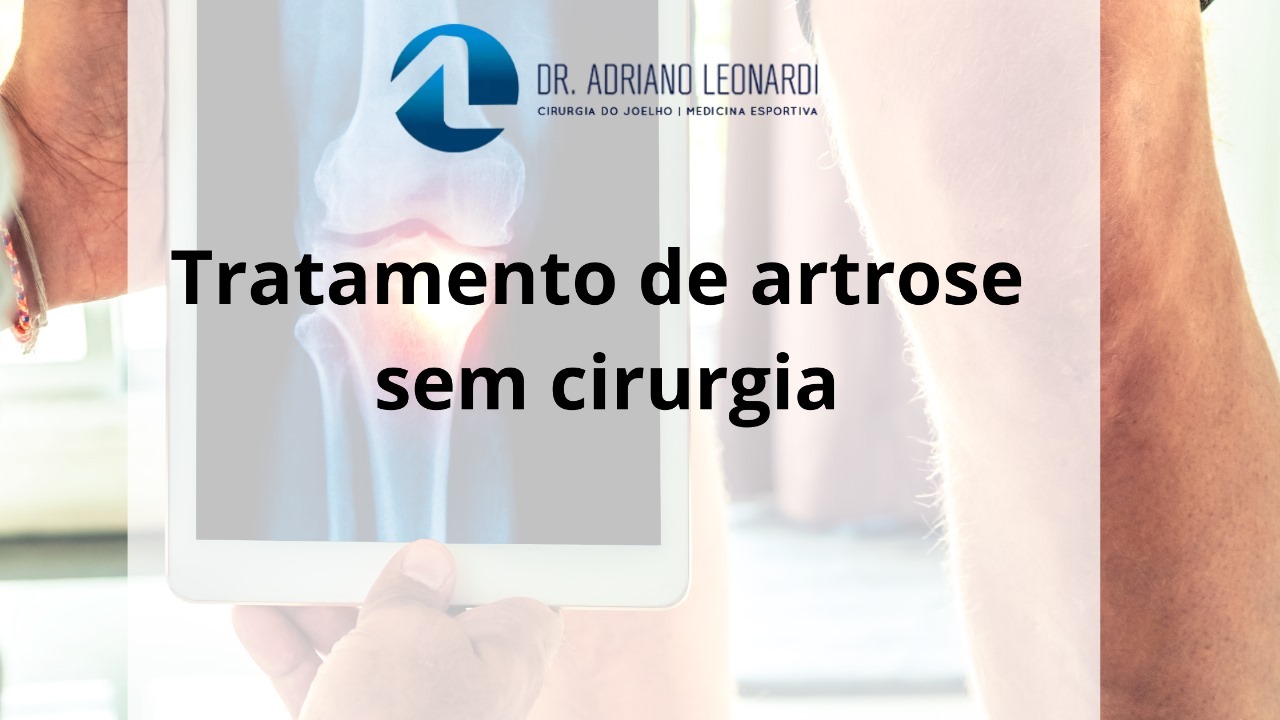 Especialista Do Joelho | Dr. Adriano Leonardi Tratamento De Artrose Sem ...