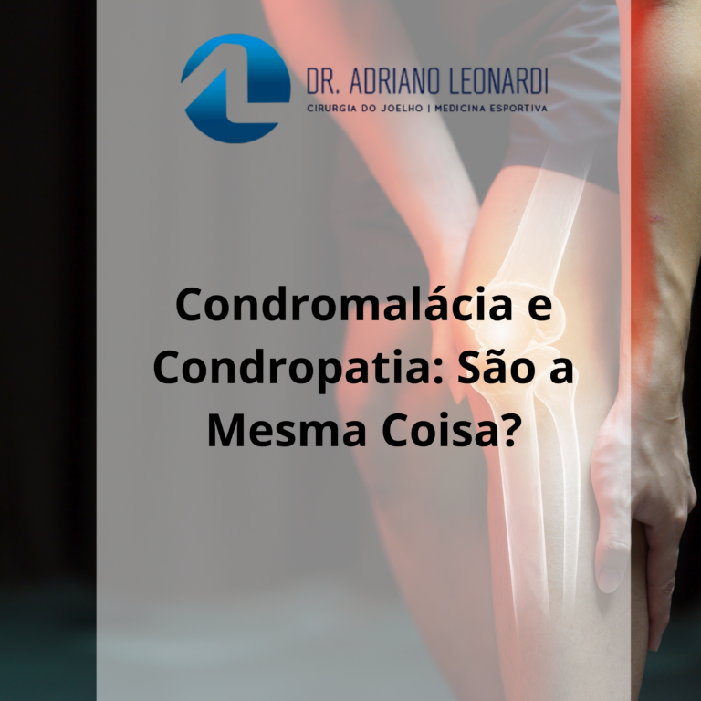 Condromalácia e Condropatia São a Mesma Coisa