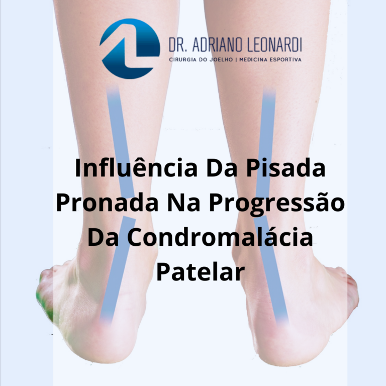 INFLUÊNCIA DA PISADA PRONADA NA PROGRESSÃO DA CONDROMALÁCIA PATELAR