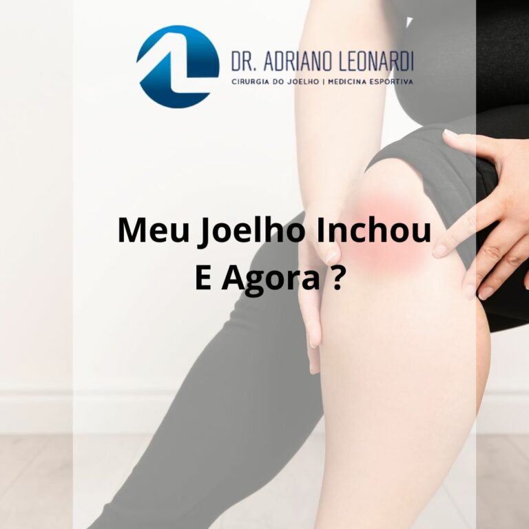 MEU JOELHO INCHOU! E AGORA? - ARTROSE