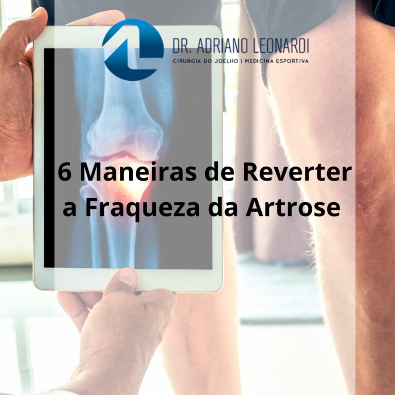 6 MANEIRAS DE REVERTER A FRAQUEZA DA ARTROSE
