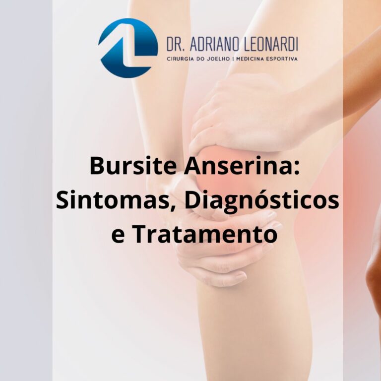 BURSITE ANSERINA: SINTOMAS, DIAGNÓSTICO E TRATAMENTO