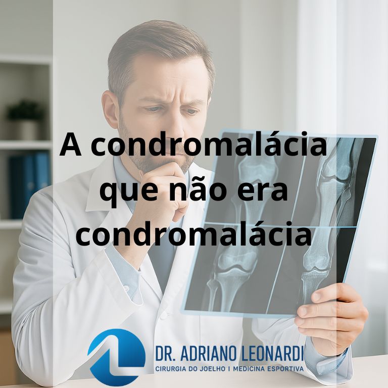 condromalácia