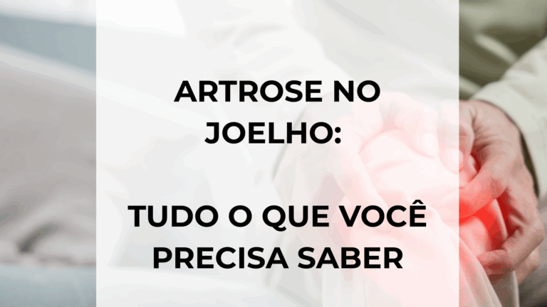 Artrose no joelho: tudo o que você precisa saber