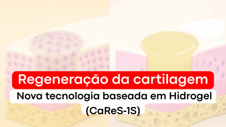 Regeneração da cartilagem: Nova tecnologia baseada em Hidrogel (CaReS‑1S)
