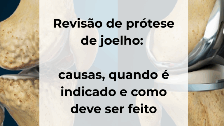Revisão de prótese de joelho