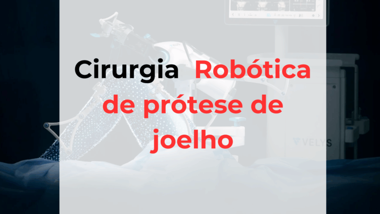 Cirurgia robótica de prótese de joelho 2