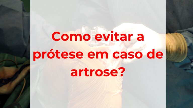 Como evitar a prótese em caso de artrose?