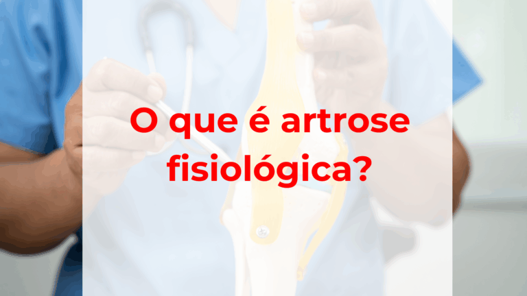 O que é artrose fisiológica