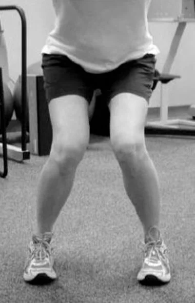 Por que mulheres têm mais problemas de joelho?