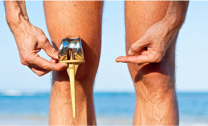 Como evitar a prótese em caso de artrose?