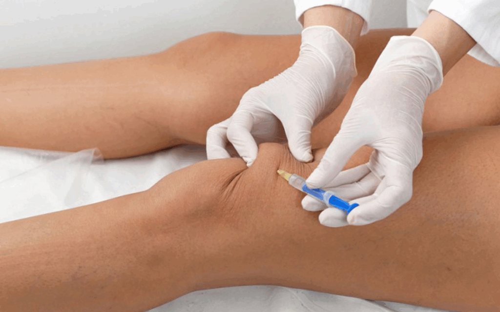 Diferença entre infiltração com ácido hialurônico e com corticoide